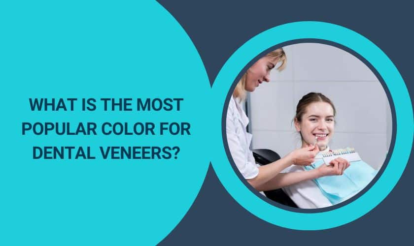 What Is The Most Popular Color For Dental Veneers?