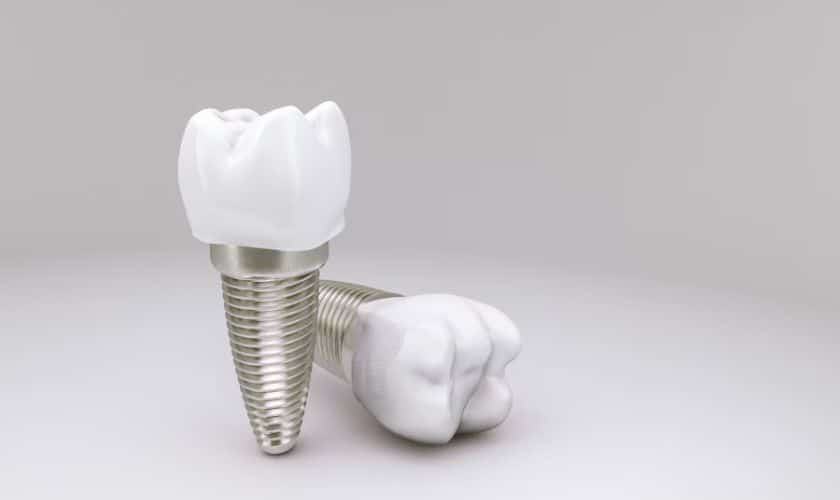 Dental Implants in Phoenix, AZ