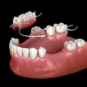 bcr dentistry phoenix az services dentures and bridges image